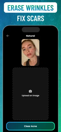 Acnefix screenshot 3